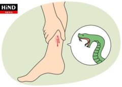 સર્પદંશથી થતા માનવ મૃત્યુને ઘટાડવા માટે ઝેરી સાપોમાંથી જ બનાવેલું એન્ટિવેનમ ઉપલબ્ધ થશે